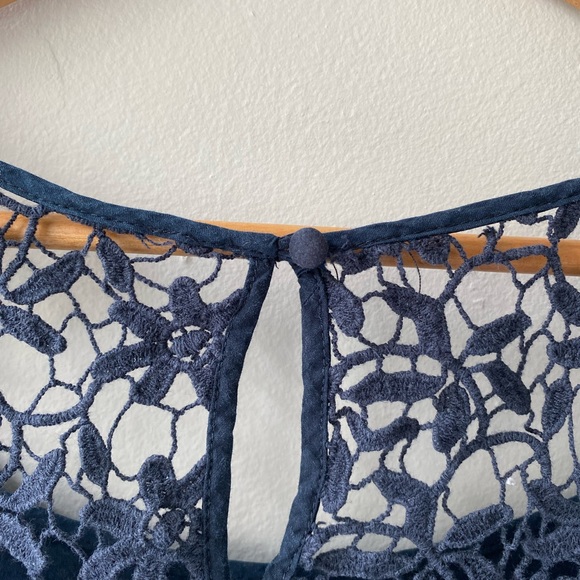 Moulinette Soeurs Dress, Lace Back, Size 12 - Picture 5 of 11